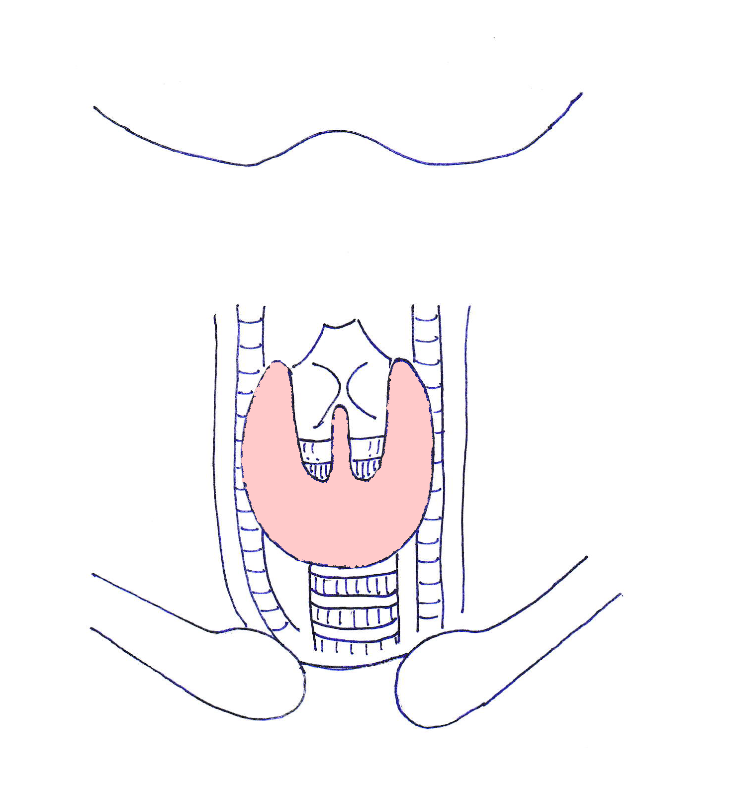 koujosen